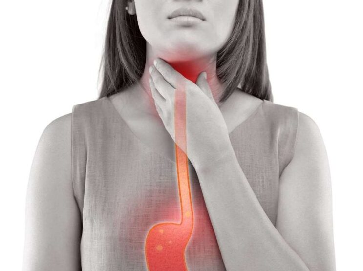 Használhat-e citromos vizet a reflux kezelésére?