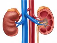 Amit a nefritiszről (vesegyulladás) tudnia kell