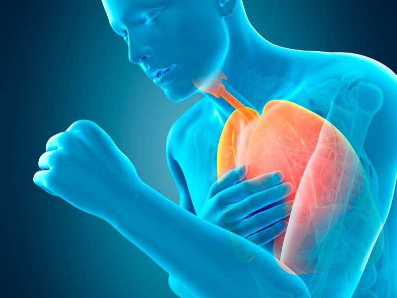 Emfizéma és COPD